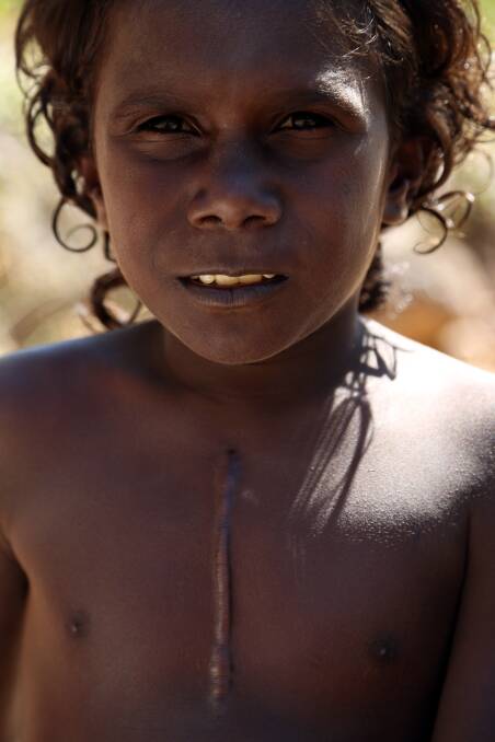 Patient, Trenton's journey with Rheumatic Heart Disease is captured in the documentary. Picture: Supplied. 