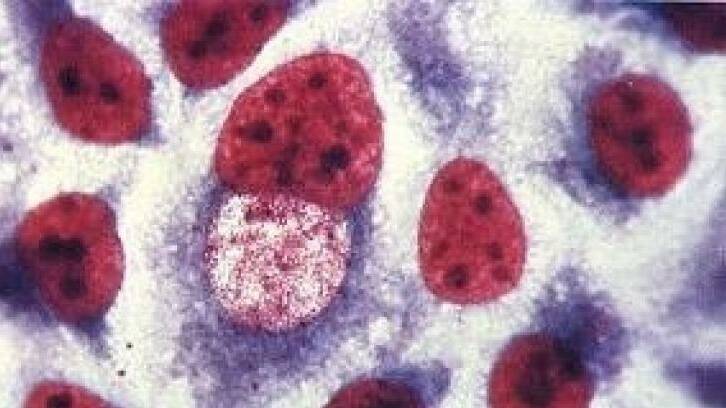 Chlamydia trachomatis bacteria.